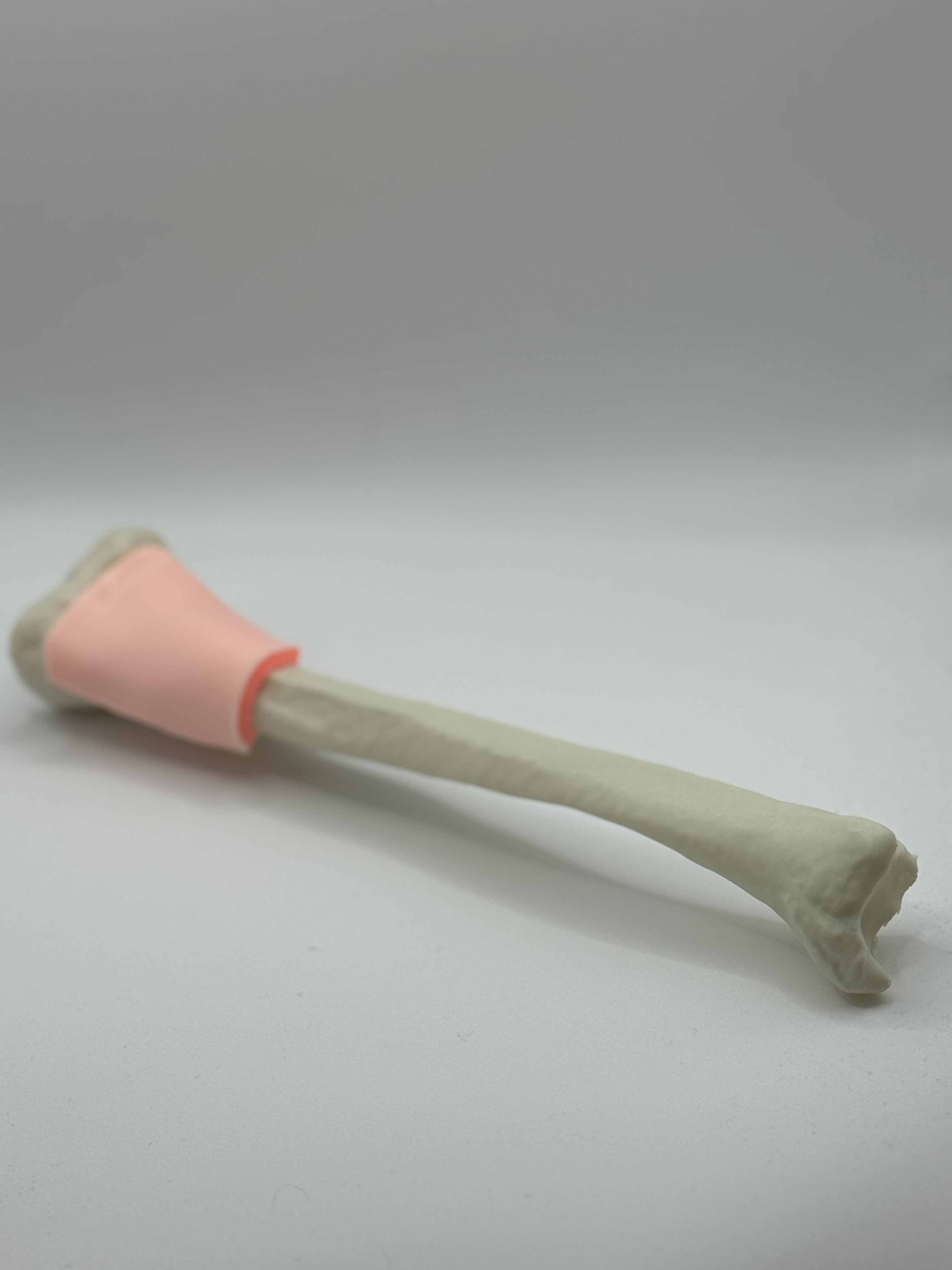 EZ-IO Distal Adult Tibia Bone - With Skin patch
