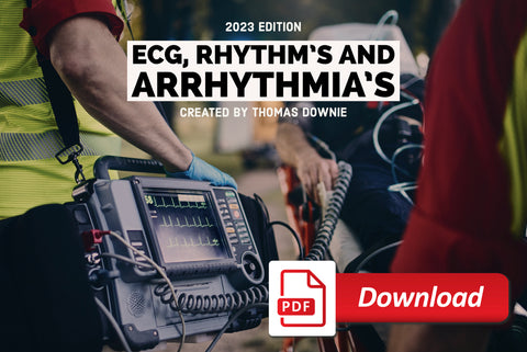 ECG, Rhythm’s and Arrhythmia’s - PDF Download