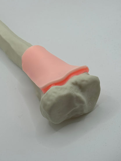 EZ-IO Distal Adult Tibia Bone - With Skin patch