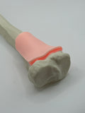 EZ-IO Distal Adult Tibia Bone - With Skin patch