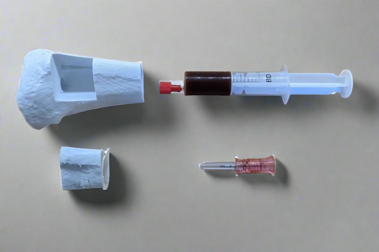 OpenTibia Intraosseous Access Training Device